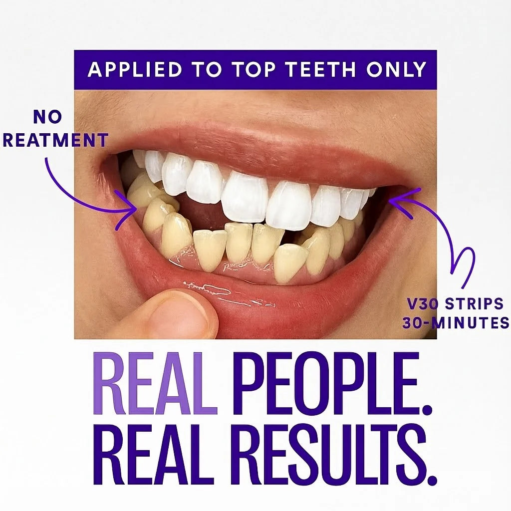 Arconism™ Purple Teeth Whitening Strips