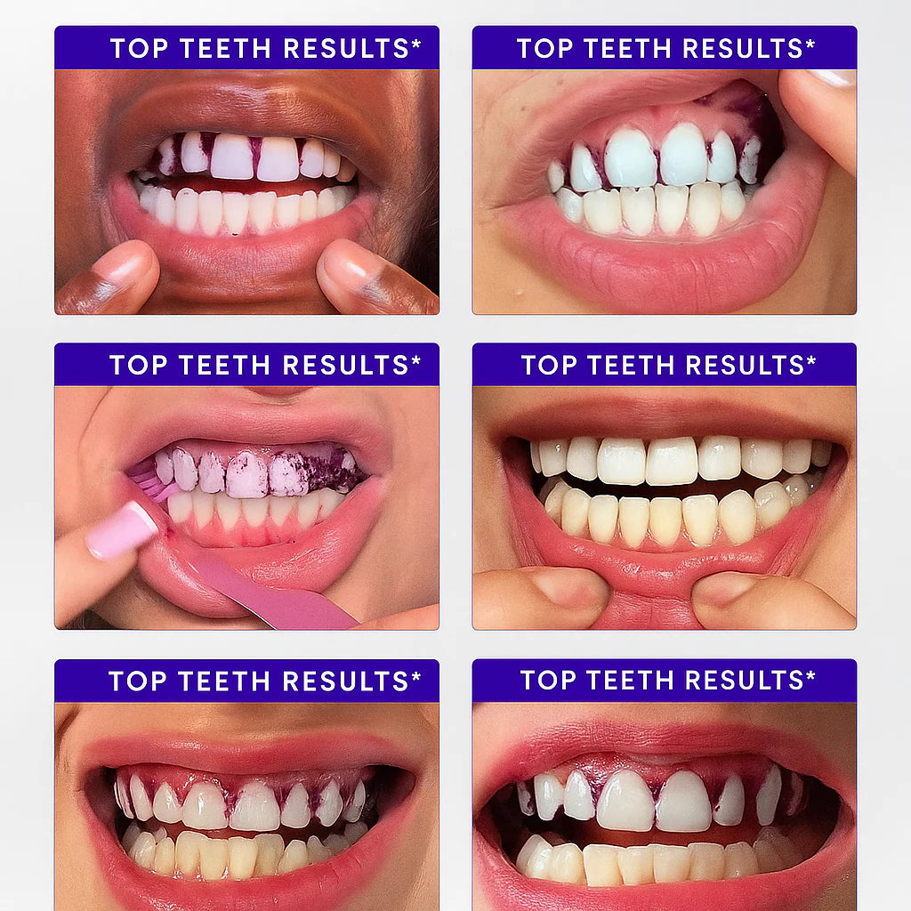 Arconism™ Purple Teeth Whitening Strips
